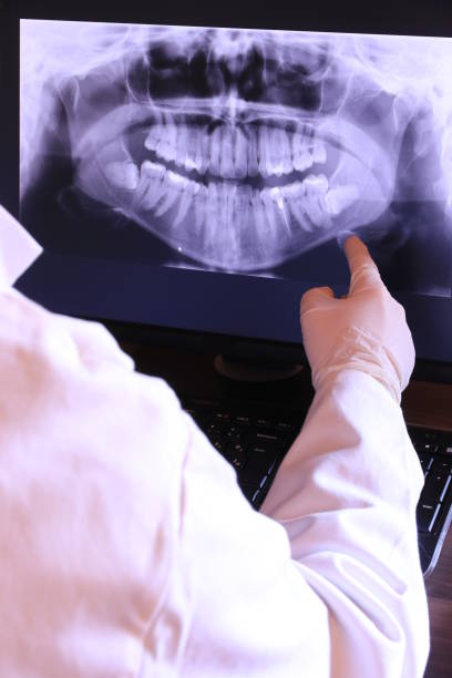 Best Emergency Dental Care for Abscessed Tooth in Salmon Brook, CT